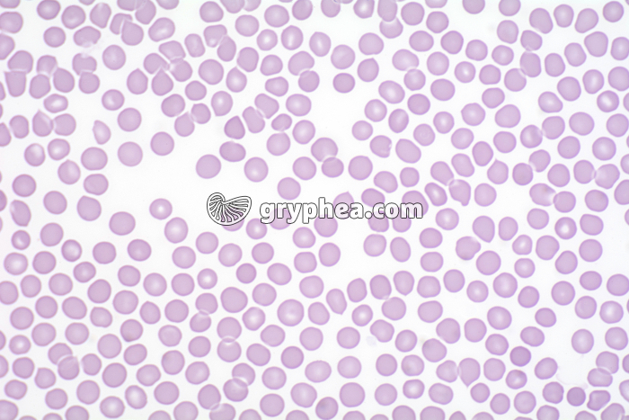 Hématies (globules rouges) Sang humain x200 - gryphea.org